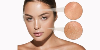 A bőrápolás szupersztárja, a sokoldalú retinol