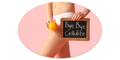 3 ok & 3 megoldás a narancsbőr ellen