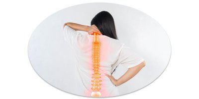 Csontritkulás - már fiataloknál is?