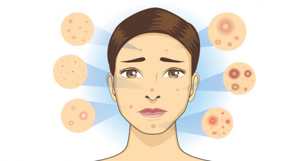 anti aging és pattanásos bőrápoló rendszer új arc biogén ránctalanító krém